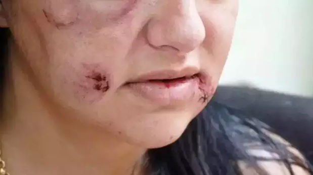 Câmara de Aparecida aprova projeto do vereador Tatá Teixeira que garante reconstrução dentária a mulheres vítimas de violência doméstica — imagem secundária